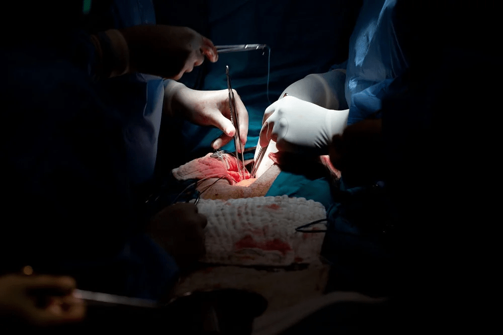 tipos de cirurgia